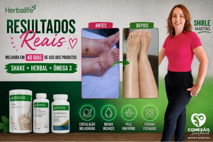 Resultado de Shirle Martins: 40 dias Shake + Herbal + Ômega 3
